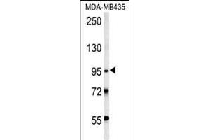 TRHDE Antibody (C-term) (ABIN651822 and ABIN2840414) western blot analysis in MDA-M cell line lysates (15 μg/lane). (TRHDE 抗体  (C-Term))