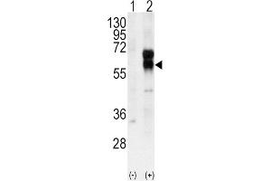 Western Blotting (WB) image for anti-Activin A Receptor Type II-Like 1 (ACVRL1) antibody (ABIN3003504)