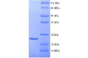 SDS-PAGE (SDS) image for Matrix Metallopeptidase 7 (Matrilysin, Uterine) (MMP7) (AA 98-267), (full length) protein (His tag) (ABIN7479052)