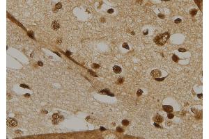 ABIN6269215 at 1/100 staining Human brain tissue by IHC-P. (CDC25C 抗体  (Internal Region))