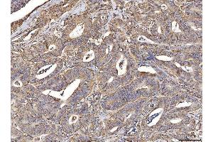 IHC analysis of ACADM/MCAD using anti-ACADM/MCAD antibody (ABIN7601543). (Medium-Chain Specific Acyl-CoA Dehydrogenase, Mitochondrial (MCAD) (AA 38-401) 抗体)
