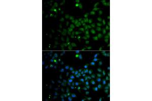Immunofluorescence analysis of A549 cells using SMAD9 antibody (ABIN5975592). (SMAD9 抗体)