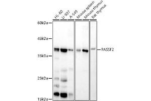Western blot analysis of extracts of various cell lines, using R antibody (ABIN7269858) at 1:500 dilution. (RASSF2 抗体)