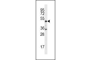 DSN1 Antibody (C-term) (ABIN656747 and ABIN2845971) western blot analysis in MDA-M cell line lysates (35 μg/lane). (DSN1 抗体  (C-Term))