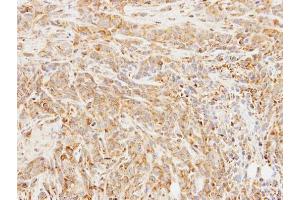 IHC-P Image Immunohistochemical analysis of paraffin-embedded SAS xenograft, using BCHE, antibody at 1:100 dilution. (Butyrylcholinesterase 抗体)