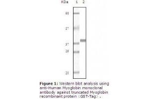 Image no. 2 for anti-Myoglobin (MB) antibody (ABIN207623) (Myoglobin 抗体)