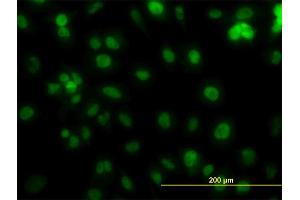 Immunofluorescence of monoclonal antibody to PCNA on HeLa cell. (PCNA 抗体  (AA 1-261))