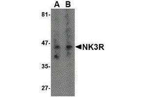 Western Blotting (WB) image for anti-Tachykinin Receptor 3 (TACR3) antibody (ABIN2476672) (TACR3 抗体)