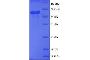 SDS-PAGE (SDS) image for Casein Kinase 1, epsilon (CSNK1E) (AA 17-231) protein (GST tag) (ABIN7479200)