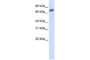 TRIM45 antibody used at 1 ug/ml to detect target protein. (TRIM45 抗体  (N-Term))