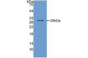 Western Blotting (WB) image for anti-Toll-Interleukin 1 Receptor (TIR) Domain Containing Adaptor Protein (TIRAP) (AA 1-221) antibody (ABIN7441712)