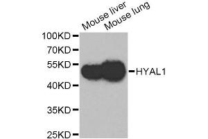 Western blot analysis of extracts of various cell lines, using HYAL1 Antibody. (HYAL1 抗体)