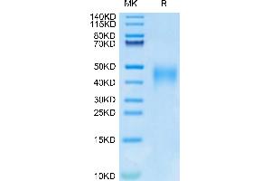 Human IL-9 on Tris-Bis PAGE under reduced condition. (IL-9 Protein (AA 19-144) (His tag))