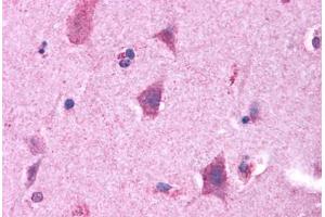 Anti-GPRC5B antibody  ABIN1048911 IHC staining of human brain. (GPRC5B 抗体  (N-Term))