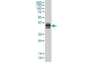 ST3GAL2 monoclonal antibody (M01), clone 1E12 Western Blot analysis of ST3GAL2 expression in K-562 . (ST3GAL2 抗体  (AA 28-127))