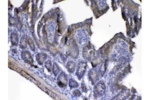 IHC analysis of Cytochrome C using anti-Cytochrome C antibody . (Cytochrome C 抗体  (AA 2-105))