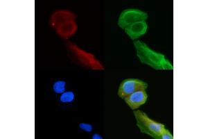 ABIN6257463 and ABIN6275093 staining Hela cells(30 min of UV treatment) by IF/ICC.