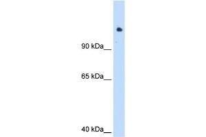 WB Suggested Anti-SMARCAL1 Antibody Titration:  1. (SMARCAL1 抗体  (C-Term))