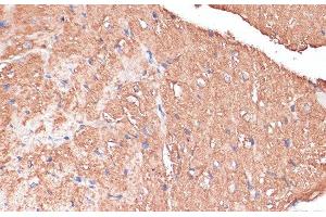 Immunohistochemistry of paraffin-embedded Mouse heart using FRMD6 Polyclonal Antibody at dilution of 1:100 (40x lens).