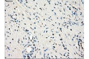 Immunohistochemical staining of paraffin-embedded endometrium tissue using anti-LTA4Hmouse monoclonal antibody. (LTA4H 抗体)