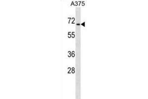 Western Blotting (WB) image for anti-Chromodomain Protein, Y-Like (CDYL) antibody (ABIN2998873) (CDYL 抗体)