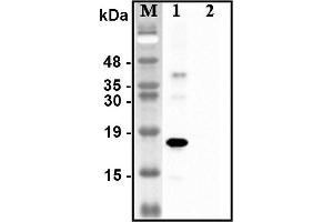 Western blot analysis of recombinant human CTRPs using anti-CTRP1 (human), pAb  at 1:4,000 dilution. (C1QTNF1 抗体)