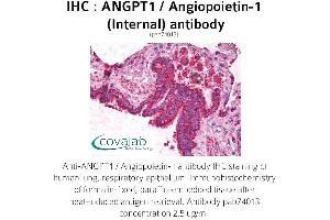 Image no. 1 for anti-Angiopoietin 1 (ANGPT1) (Internal Region) antibody (ABIN1731781) (Angiopoietin 1 抗体  (Internal Region))