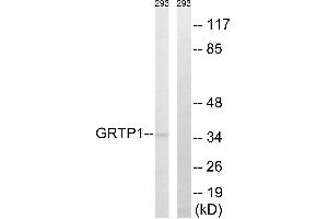 Western blot analysis of extracts from 293 cells, using GRTP1 antibody. (GRTP1 抗体  (Internal Region))