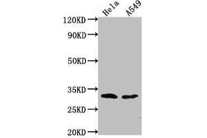 Western Blot Positive WB detected in: Hela whole cell lysate, A549 whole cell lysate All lanes: VAX2 antibody at 1:2000 Secondary Goat polyclonal to rabbit IgG at 1/50000 dilution Predicted band size: 31 kDa Observed band size: 31 kDa (VAX2 抗体  (AA 1-74))