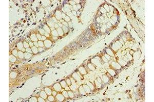 Immunohistochemistry of paraffin-embedded human colon tissue using ABIN7146811 at dilution of 1:100 (CEACAM8 抗体  (AA 35-320))