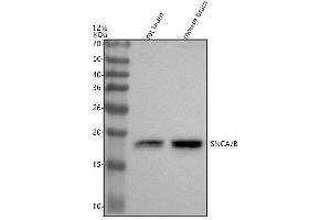 Western blot analysis of SNCA/B using anti-SNCA/B antibody (ABIN7603956).
