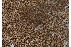 ABIN6257848 and ABIN6273703 at 1/100 staining Mouse spleen tissue by IHC-P. (KIF23 抗体  (Internal Region))