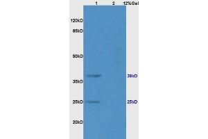 SDS-PAGE (SDS) image for anti-Killer Cell Lectin-Like Receptor Subfamily B, Member 1 (KLRB1) (AA 151-225) antibody (ABIN680998)
