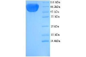 SDS-PAGE (SDS) image for Keratin 77 (KRT77) (AA 1-578), (full length) protein (His tag) (ABIN5714404)