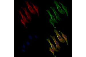 ABIN6263361 and ABIN6279016 staining 3 by IF/ICC. (MRPL17 抗体  (Internal Region))