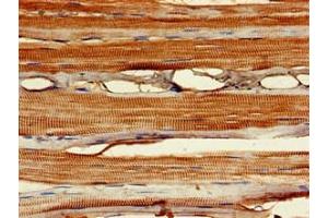 Immunohistochemistry of paraffin-embedded human skeletal muscle tissue using ABIN7160518 at dilution of 1:100 (MYF6 抗体  (AA 26-232))
