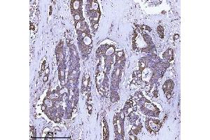 anti-Ataxin 2 (ATXN2) (AA 1278-1313) antibody