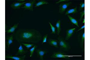 Immunofluorescence of purified MaxPab antibody to PRKD1 on HeLa cell. (PKC mu 抗体  (AA 1-912))