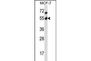 Mouse Akt2 Antibody (N-term) (ABIN657827 and ABIN2846794) western blot analysis in MCF-7 cell line lysates (35 μg/lane).