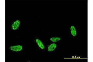 Immunofluorescence of monoclonal antibody to PRKRIP1 on HeLa cell. (PRKRIP1 抗体  (AA 1-184))