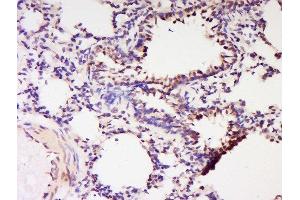 Formalin-fixed and paraffin embedded rat lung labeled with Anti-RNF56 Polyclonal Antibody, Unconjugated  at 1:200 followed by conjugation to the secondary antibody and DAB staining. (Cbl Proto-Oncogene B, E3 Ubiquitin Protein Ligase (CBLB) (AA 101-200) 抗体)