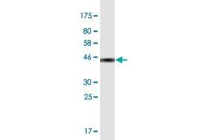 Western Blotting (WB) image for anti-Superoxide Dismutase 1, Soluble (SOD1) (AA 1-154) antibody (ABIN948490)