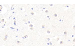 Detection of AFM in Human Cerebrum Tissue using Polyclonal Antibody to Afamin (AFM) (Afamin 抗体  (AA 22-210))