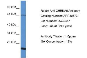 WB Suggested Anti-CHRNA6 Antibody   Titration: 1. (CHRNA6 抗体  (N-Term))