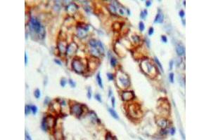 Used in DAB staining on fromalin fixed paraffin-embedded Stomach tissue (KLRC2 抗体  (AA 19-190))