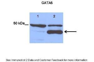 Lanes:   Lane 1: 25 ug empty vector transfected H460 cell lysate Lane 2: 25 ug hGATA5 transfected H460 cell lysate  Primary Antibody Dilution:   1:1200  Secondary Antibody:   Anti-rabbit HRP  Secondary Antibody Dilution:   1:3500  Gene Name:   GATA5  Submitted by:   Anonymous (GATA5 抗体  (Middle Region))