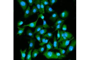 IF analysis of EIF5A using anti-EIF5A antibody (ABIN7599674). (EIF5A 抗体  (AA 107-154))
