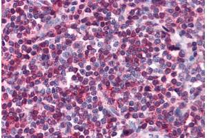 Human Tonsil: Formalin-Fixed, Paraffin-Embedded (FFPE) (SELPLG 抗体)