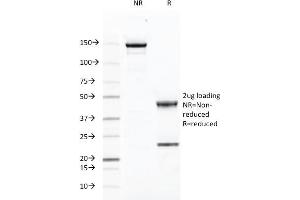 SDS-PAGE Analysis Purified CD46 Mouse Monoclonal Antibody (169-1-E4. (CD46 抗体)