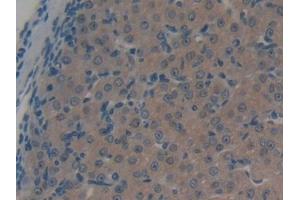DAB staining on IHC-P; Samples: Mouse Ovary Tissue (ABCC1 抗体  (AA 1219-1469))